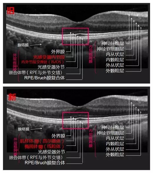 眼底OCT分層，一文教你全看懂！